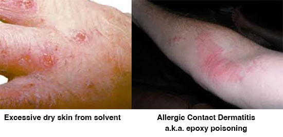 skin problems